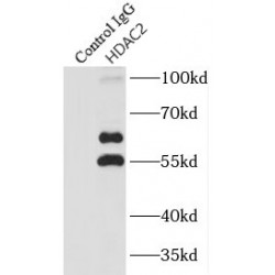 Histone Deacetylase 2 (HDAC2) Antibody