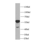 WB analysis of HEK-293 cells, using HDAC2 antibody (1/1000 dilution).