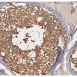 Histone Deacetylase 6 (HDAC6) Antibody