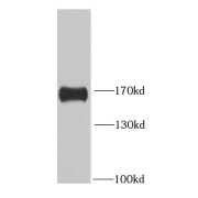 WB analysis of K-562 cells, using HDAC6 antibody (1/1000 dilution).