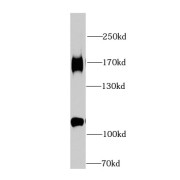 WB analysis of MCF7 cells, using HDAC6 antibody (1/1000 dilution).