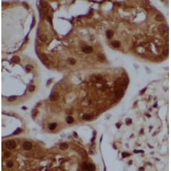 HD Domain Containing Protein 3 (HDDC3) Antibody