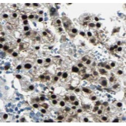 Hepatoma Derived Growth Factor (HDGF) Antibody