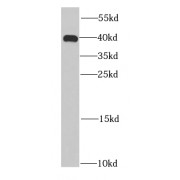 WB analysis of SMMC-7721 cells, using HDGF antibody (1/5000 dilution).