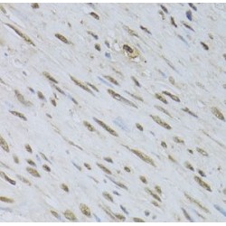 Hepatoma Derived Growth Factor-Related Protein 3 (HDGFRP3) Antibody