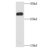 WB analysis of human brain tissue, using HDGFRP3 antibody (1/1000 dilution).