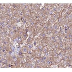 Heme-Binding Protein 1 (HEBP1) Antibody