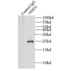 Heme-Binding Protein 2 (HEBP2) Antibody