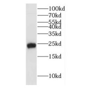 WB analysis of human brain tissue, using HEBP2 antibody (1/500 dilution).