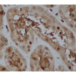 E3 Ubiquitin-Protein Ligase HECTD1 (HECTD1) Antibody