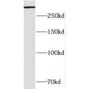 WB analysis of human brain tissue, using HECTD1 antibody (1/500 dilution).