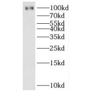 WB analysis of MCF-7 cells, using HECTD3 antibody (1/2000 dilution).