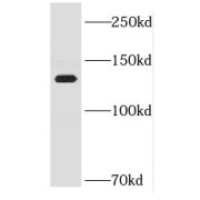 WB analysis of Jurkat cells, using HELB antibody (1/1000 dilution).