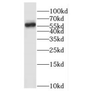 WB analysis of Jurkat cells, using HEMGN antibody (1/500 dilution).