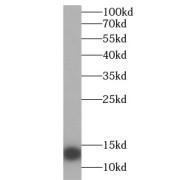 WB analysis of mouse liver, using Hemoglobin alpha antibody (1/1000 dilution).