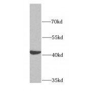 WB analysis of HeLa cells, using Hemoglobin epsilon-Specific antibody (1/600 dilution).