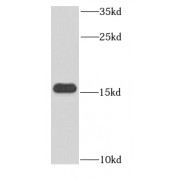 WB analysis of HeLa cells, using Hemoglobin epsilon-Specific antibody (1/300 dilution).