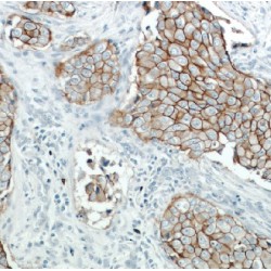 HER2 / ErbB2 Antibody