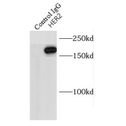 HER2 / ErbB2 Antibody