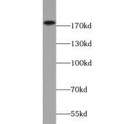 WB analysis of HeLa cells, using ERBB2 antibody (1/300 dilution).