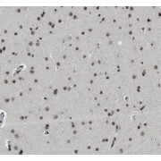 IHC-P analysis of human brain tissue, using HESX1 Antibody (1/50 dilution).