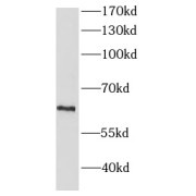 WB analysis of Jurkat cells cells, using HEXA antibody (1/10000 dilution).