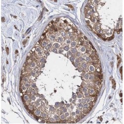 Hexokinase 1 (HK1) Antibody