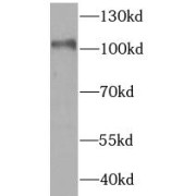 WB analysis of THP1 cells, using HK1 antibody (1/1000 dilution).