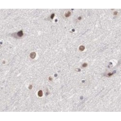 Hairy/enhancer-Of-Split Related With YRPW Motif Protein 1 (HEY1) Antibody