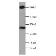 WB analysis of DU 145 cells, using HEY1 antibody (1/3000 dilution).