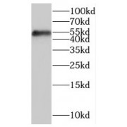 WB analysis of human placenta tissue, using HFE antibody (1/300 dilution).