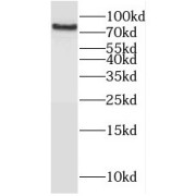 WB analysis of HEK-293 cells, using HHIP antibody (1/1000 dilution).