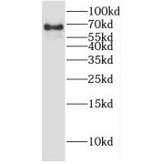 WB analysis of Jurkat cells, using HIC1 antibody (1/1000 dilution).