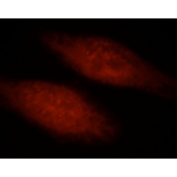 Hypoxia Inducible Factor 1 Alpha (HIF1a) Antibody