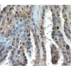 Hypoxia Inducible Factor 1 Alpha (HIF1a) Antibody