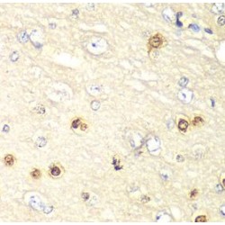 Hypoxia Inducible Factor 1 Alpha Inhibitor (HIF1AN) Antibody