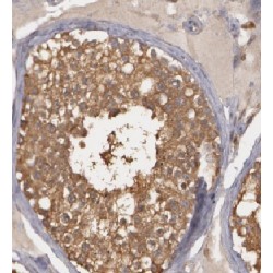 HIG1 Domain Family Member 1A, Mitochondrial (HIGD1A) Antibody