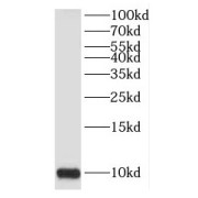 WB analysis of HeLa cells, using HIGD1A antibody (1/500 dilution).