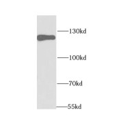 WB analysis of DU 145 cells, using HIP1 antibody (1/1000 dilution).