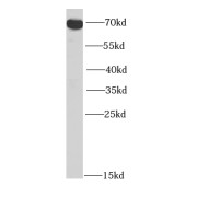 WB analysis of Raji cells, using HIP14; ZDHHC17 antibody (1/400 dilution).