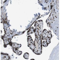 Huntingtin-Interacting Protein 1-Related Protein (HIP1R) Antibody