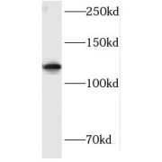 WB analysis of mouse brain tissue, using HIP1R antibody (1/2000 dilution).