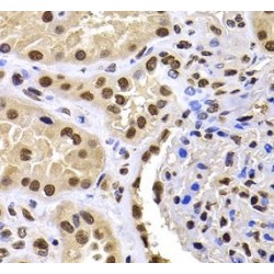 HIRA-Interacting Protein 3 (HIRIP3) Antibody