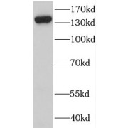 WB analysis of K-562 cells, using HISPPD1 antibody (1/1000 dilution).