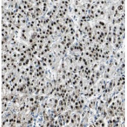 Histone H2A Type 2-A (HIST2H2AA4) Antibody