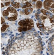 IHC-P analysis of human stomach tissue, using HIVEP1 Antibody (1/50 dilution).