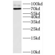 WB analysis of A549 cells, using HJURP antibody (1/800 dilution).