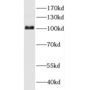 WB analysis of mouse heart tissue, using HK1 antibody (1/300 dilution).