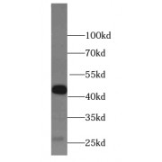 WB analysis of Jurkat cells, using HLA class I (HLA-B) antibody (1/800 dilution).