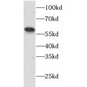 WB analysis of rat spleen tissue, using HLA-DMA antibody (1/600 dilution).